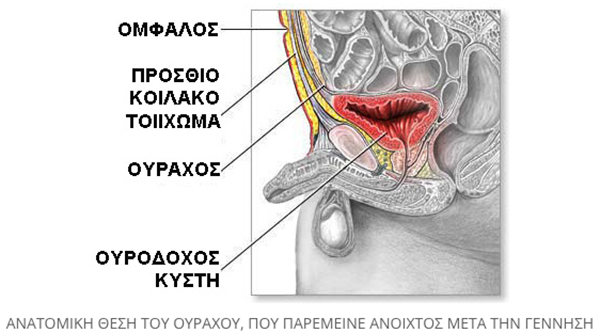 aitia karkinou ourodoxou kistis 3