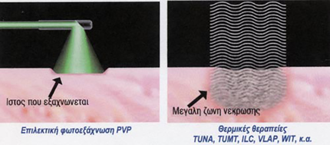 vaporisation effect petit
