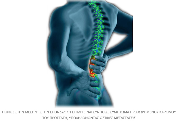 simptomata karkinou prostati 2