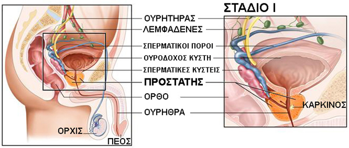 stage i