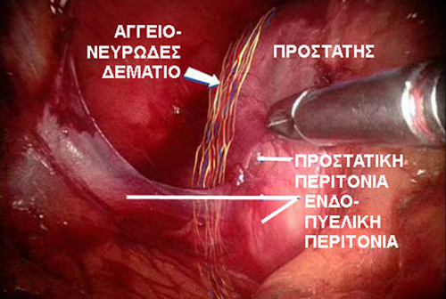 neurovascular