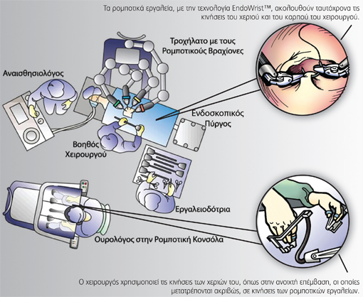 riziki nefroureterectomy opsetup