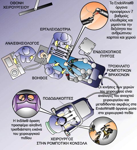 robotic surgery2