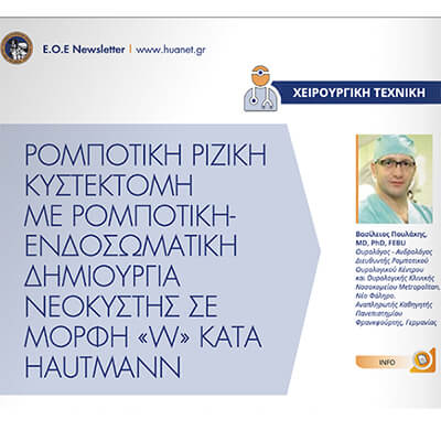 Επιστημονική δημοσίευση του δρ. Βασίλη Πουλάκη σχετικά με την ρομποτική ριζική κυστεκτομή και την ρομποτική (ενδοσωματική) δημιουργία νεοκύστης σε σχήμα «w» κατά Hautmann
