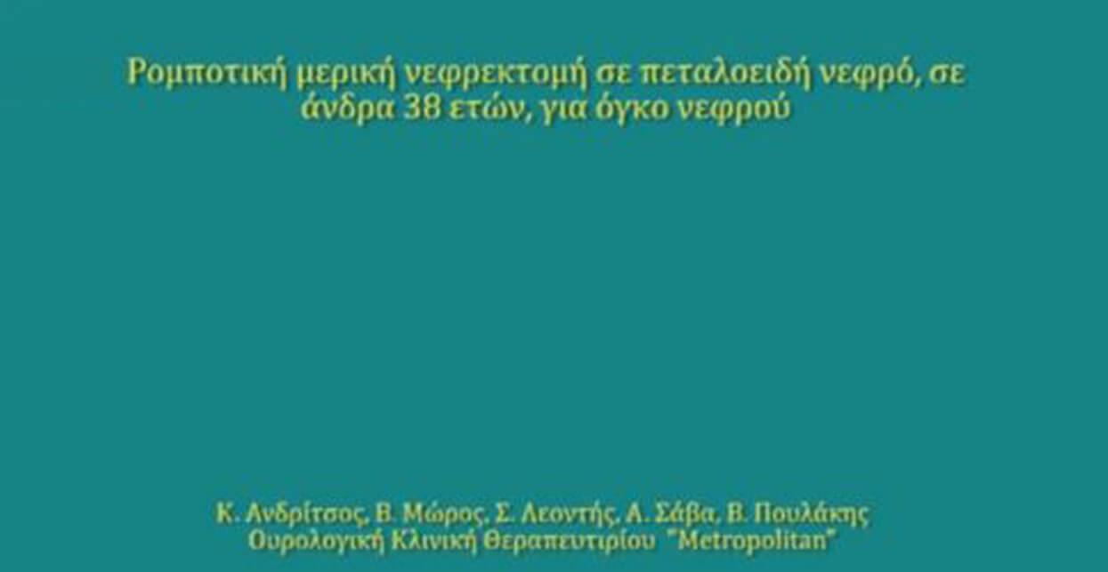 Παρουσίαση ρομποτική μερική νεφρεκτομή σε πεταλοειδή νεφρό